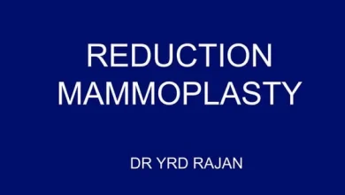 mammoplasty:-why-professionalism-matters