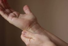 understanding-hair-loss-and-the-importance-of-skin-cancer-checks-in-sydney